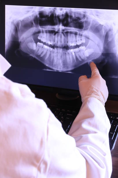 Best Emergency Tooth Extraction in Takoma Park, MD